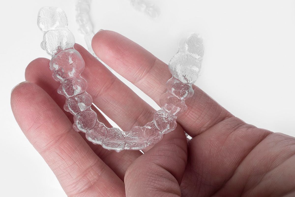 Can Invisalign Fix An Underbite?