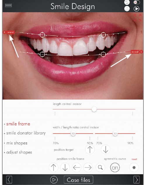 Step 2 DSD Photo