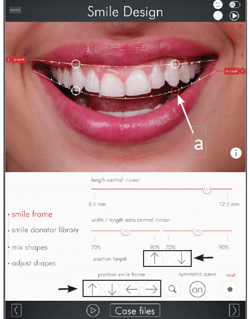 Step 2 DSD Photo