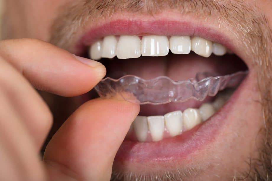 How Much Does Invisalign Cost in Belmont, MA?
