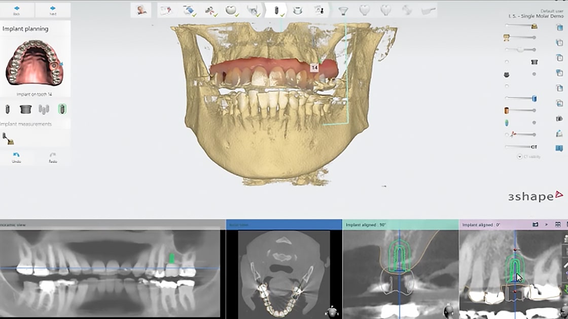 3Shape Impression Scanner