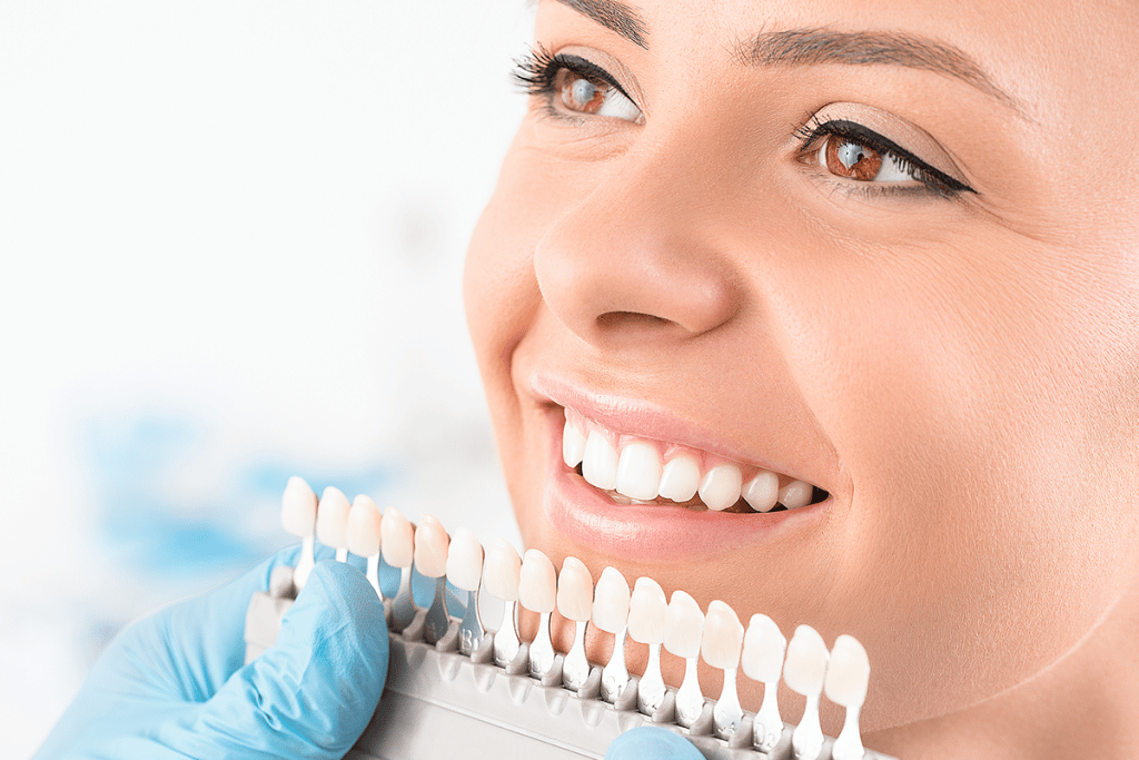 What is the Best Way to Whiten Teeth? Belmont Family Dentistry